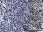 EPHB3 Antibody in Immunohistochemistry (Paraffin) (IHC (P))