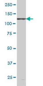 EPHB6 Antibody in Western Blot (WB)