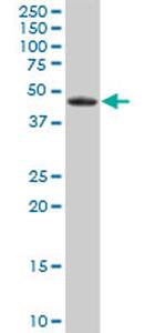 EPHX1 Antibody in Western Blot (WB)