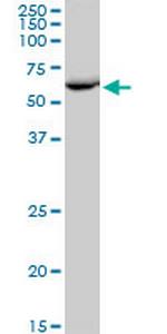 EPHX2 Polyclonal Antibody, MaxPab™
