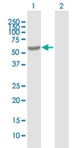 EPHX2 Polyclonal Antibody, MaxPab™