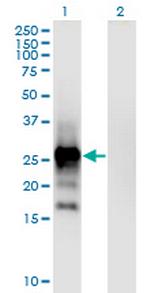EPO Monoclonal Antibody (1B12)