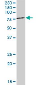EPOR Antibody in Western Blot (WB)