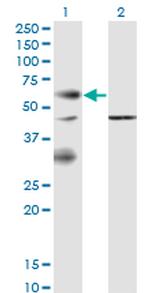 EPOR Monoclonal Antibody (3F6)