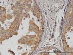 ERBB2 Antibody in Immunohistochemistry (Paraffin) (IHC (P))