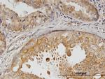 ERBB2 Antibody in Immunohistochemistry (Paraffin) (IHC (P))