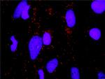 ERBB2 Antibody in Proximity Ligation Assay (PLA) (PLA)