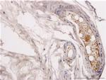 ERBB2 Antibody in Immunohistochemistry (Paraffin) (IHC (P))