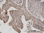 ERBB3 Antibody in Immunohistochemistry (Paraffin) (IHC (P))