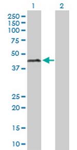 ERCC1 Polyclonal Antibody, MaxPab™