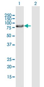 ERCC2 Antibody in Western Blot (WB)