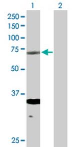ERCC2 Polyclonal Antibody, MaxPab™