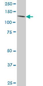 ERN1 Monoclonal Antibody (4D12)