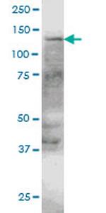 ERN1 Monoclonal Antibody (4E1)