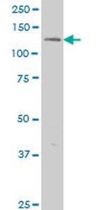 ERN1 Antibody in Western Blot (WB)