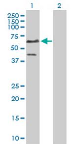 ETS1 Polyclonal Antibody, MaxPab™