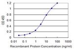 ETV1 Antibody in ELISA (ELISA)