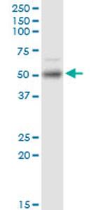 ETV1 Monoclonal Antibody (4C12)