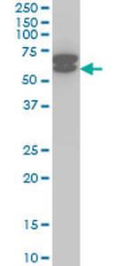 ETV6 Antibody in Western Blot (WB)