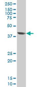EVX1 Antibody in Western Blot (WB)