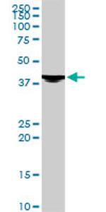 EVX1 Monoclonal Antibody (1B7)
