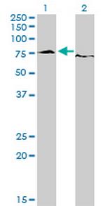 EWSR1 Monoclonal Antibody (5C10)