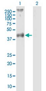 F2R Polyclonal Antibody, MaxPab™