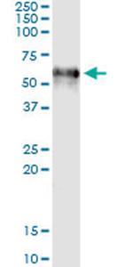 F9 Antibody in Immunoprecipitation (IP)