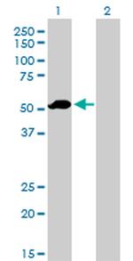 F9 Antibody in Western Blot (WB)