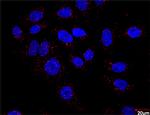 F13A1 Antibody in Proximity Ligation Assay (PLA) (PLA)