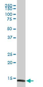 FABP4 Antibody in Western Blot (WB)