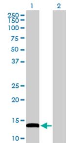 FABP4 Antibody in Western Blot (WB)