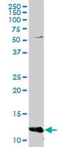 FABP4 Antibody in Western Blot (WB)