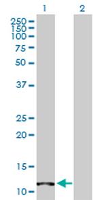 FABP4 Antibody in Western Blot (WB)