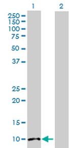 FABP1 Antibody in Western Blot (WB)