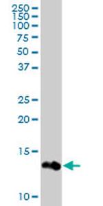 FABP1 Antibody in Western Blot (WB)