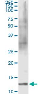 FABP1 Antibody in Immunoprecipitation (IP)