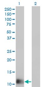 FABP1 Antibody in Western Blot (WB)