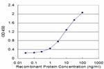 FABP1 Monoclonal Antibody (5E7)