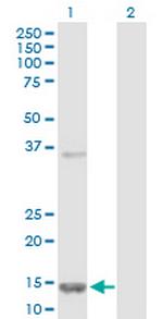 FABP5 Polyclonal Antibody, MaxPab™
