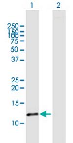FABP6 Antibody in Western Blot (WB)