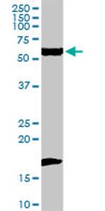 FANCC Antibody in Western Blot (WB)