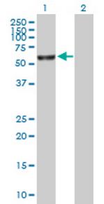 FANCE Polyclonal Antibody, MaxPab™