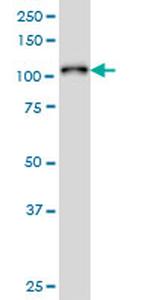 PTK2B Antibody in Western Blot (WB)
