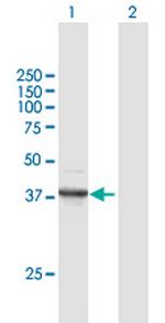 FANCF Polyclonal Antibody, MaxPab™