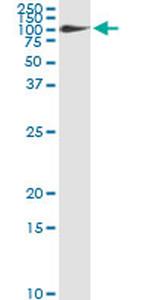 FBLN1 Antibody in Immunoprecipitation (IP)