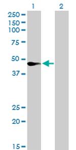 FASN Antibody in Western Blot (WB)