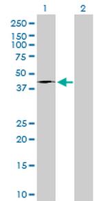 FASN Antibody in Western Blot (WB)