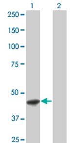 FASN Monoclonal Antibody (S1)