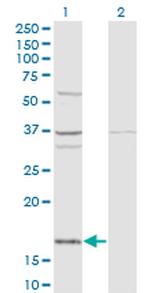 FAU Antibody in Western Blot (WB)